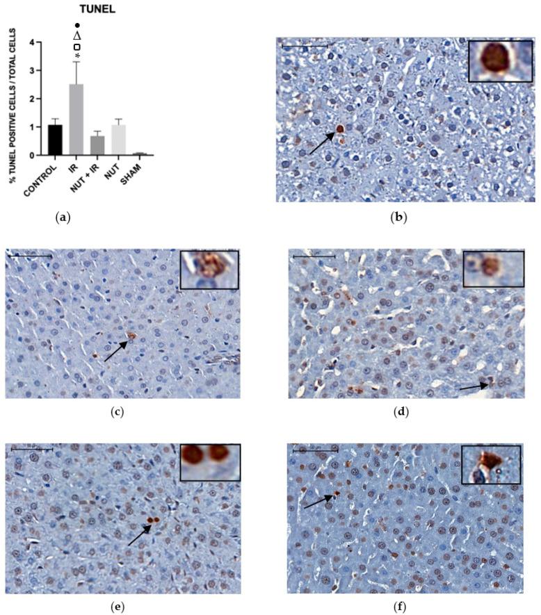https://cdn.ncbi.nlm.nih.gov/pmc/blobs/0080/10299517/0816caf7104e/ijms-24-10264-g005.jpg