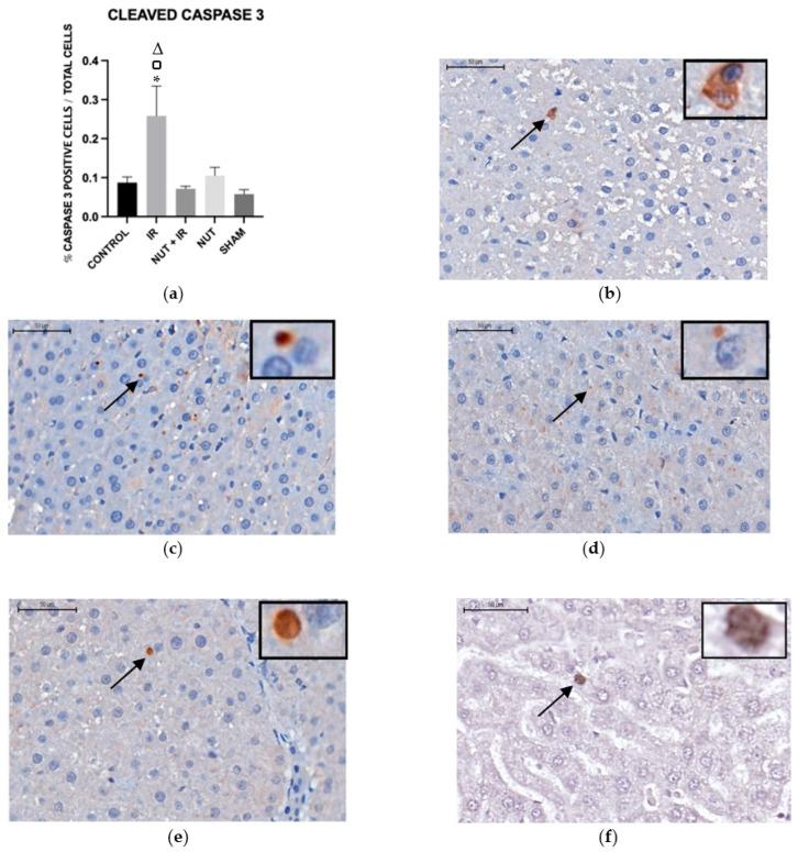 https://cdn.ncbi.nlm.nih.gov/pmc/blobs/0080/10299517/dd2b591179af/ijms-24-10264-g006.jpg