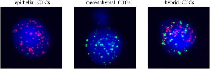 https://cdn.ncbi.nlm.nih.gov/pmc/blobs/0081/11909577/d53e88680463/j_med-2024-1074-fig001.jpg
