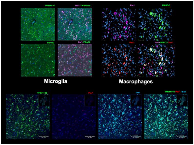 https://cdn.ncbi.nlm.nih.gov/pmc/blobs/0084/11476027/b8c34dc2cdb1/cancers-16-03283-g002.jpg