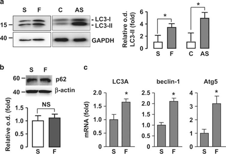 https://cdn.ncbi.nlm.nih.gov/pmc/blobs/0092/4650738/7ab0c3dc53fa/cddis2015193f2.jpg