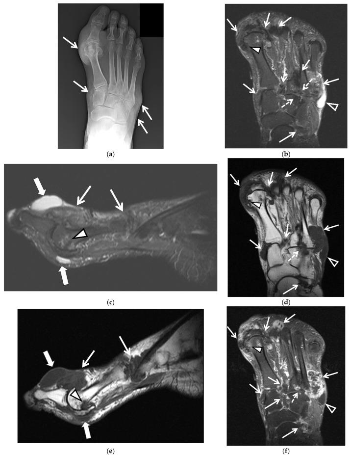 https://cdn.ncbi.nlm.nih.gov/pmc/blobs/009b/8745871/3b0f271eee4d/jcm-11-00166-g004a.jpg