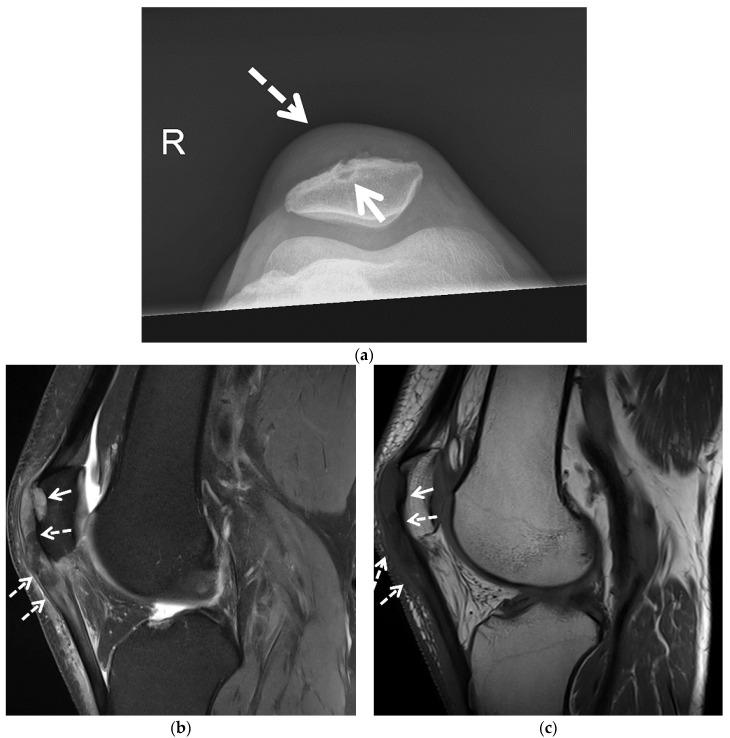 https://cdn.ncbi.nlm.nih.gov/pmc/blobs/009b/8745871/ad72a1134186/jcm-11-00166-g006.jpg