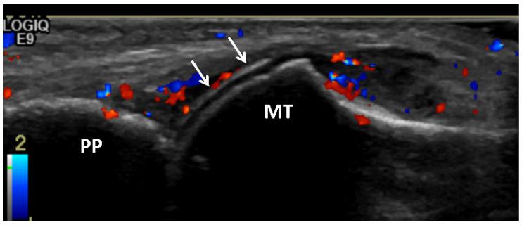 https://cdn.ncbi.nlm.nih.gov/pmc/blobs/009b/8745871/d53643a9fcaf/jcm-11-00166-g009.jpg