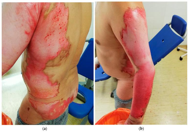 https://cdn.ncbi.nlm.nih.gov/pmc/blobs/00a1/8834952/950b4b1331af/ijerph-19-01338-g005.jpg