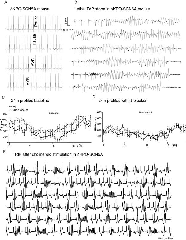 https://cdn.ncbi.nlm.nih.gov/pmc/blobs/00a3/2883895/ec8d526c5ead/cvq02902.jpg