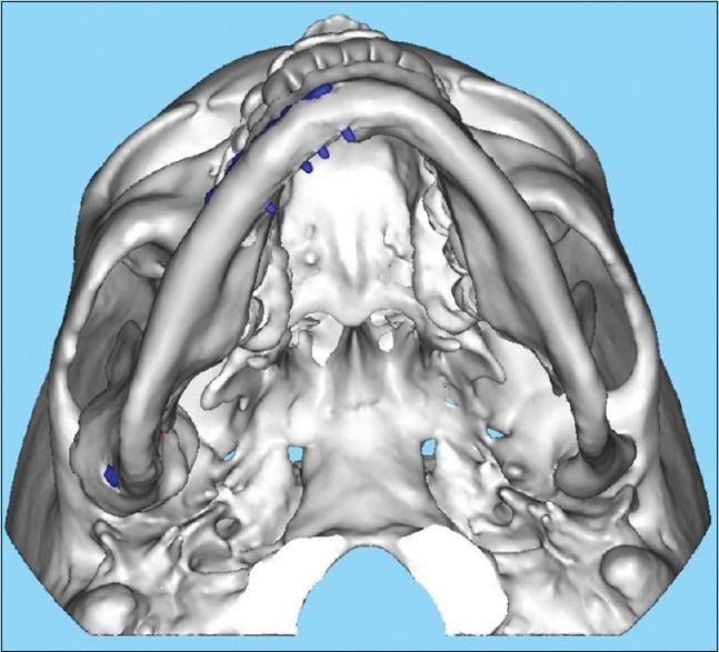 https://cdn.ncbi.nlm.nih.gov/pmc/blobs/00a5/8051664/0c0b5803e834/NJMS-11-270-g004.jpg