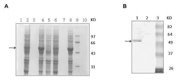 https://cdn.ncbi.nlm.nih.gov/pmc/blobs/00ab/2894783/44f3f2dc8205/1743-422X-7-99-1.jpg
