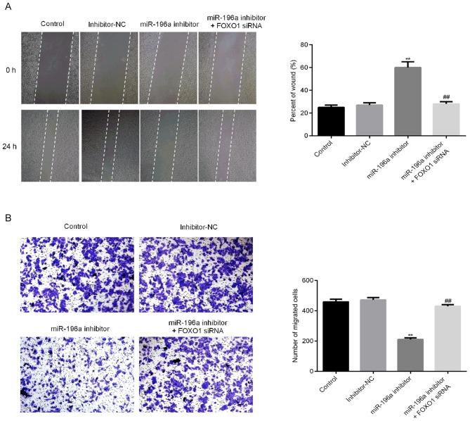 https://cdn.ncbi.nlm.nih.gov/pmc/blobs/00b7/7185189/a0a71de07fda/etm-19-06-3707-g05.jpg