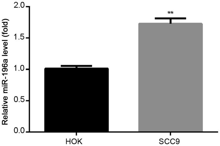 https://cdn.ncbi.nlm.nih.gov/pmc/blobs/00b7/7185189/b4c4418b72ff/etm-19-06-3707-g00.jpg