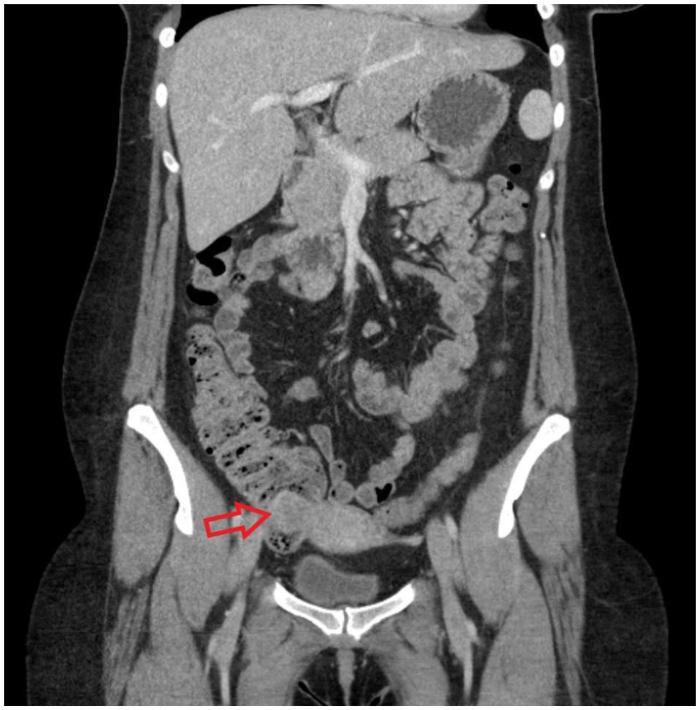 https://cdn.ncbi.nlm.nih.gov/pmc/blobs/00bb/7930353/65a374452113/gr2.jpg