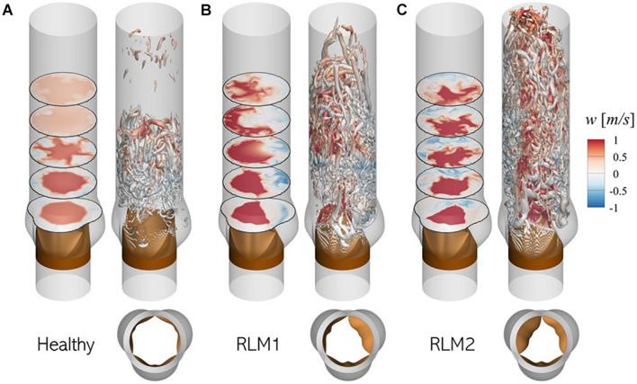 https://cdn.ncbi.nlm.nih.gov/pmc/blobs/00bb/8526559/3b266badcb09/fphys-12-734224-g007.jpg