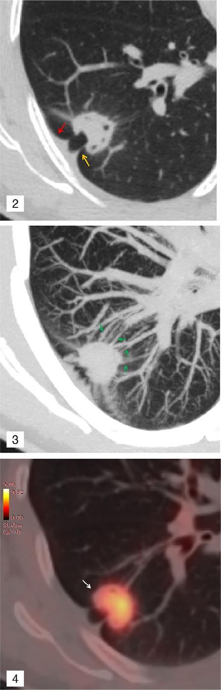 https://cdn.ncbi.nlm.nih.gov/pmc/blobs/00c2/10679694/2b538b927a7e/DIR-29-379-g2.jpg
