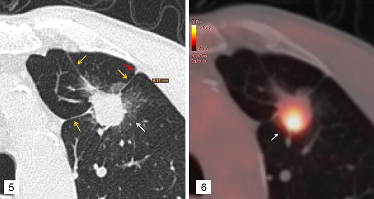 https://cdn.ncbi.nlm.nih.gov/pmc/blobs/00c2/10679694/460ddccde89b/DIR-29-379-g3.jpg
