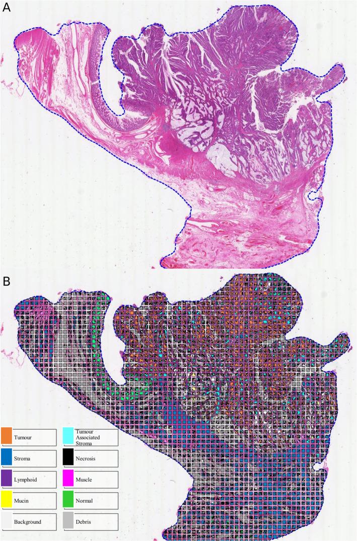 https://cdn.ncbi.nlm.nih.gov/pmc/blobs/00c7/11163018/5cf9e01ae901/CJP2-10-e12385-g006.jpg