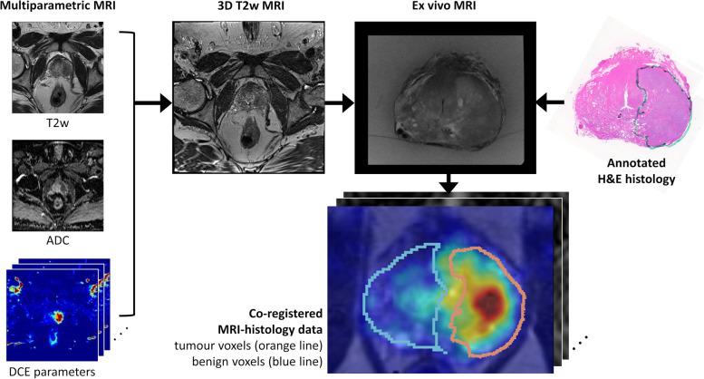 https://cdn.ncbi.nlm.nih.gov/pmc/blobs/00ca/9762110/742eb3ca039f/40644_2022_508_Fig2_HTML.jpg