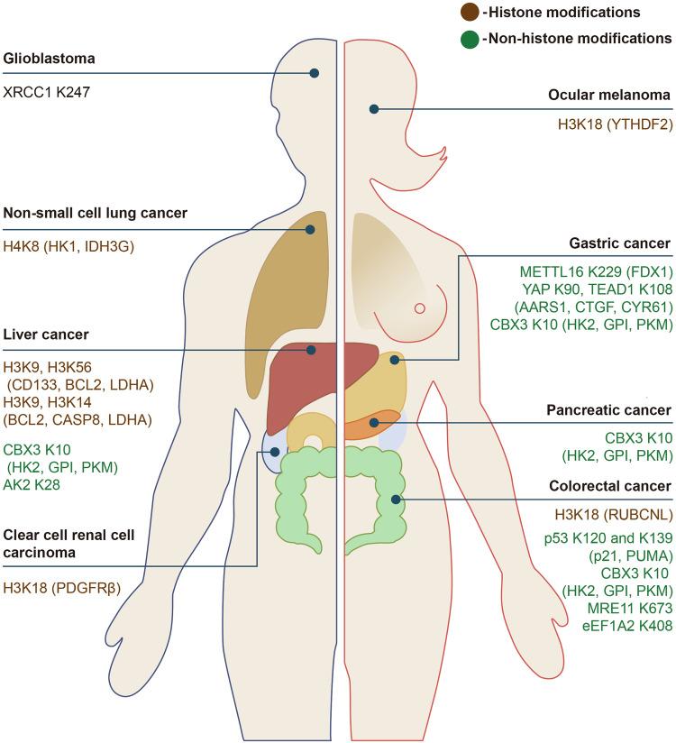 https://cdn.ncbi.nlm.nih.gov/pmc/blobs/00cc/11814237/37d4fa886474/41392_2024_2082_Fig5_HTML.jpg