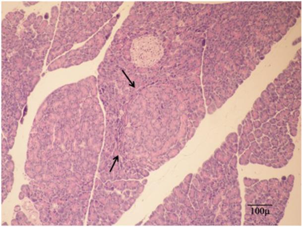 https://cdn.ncbi.nlm.nih.gov/pmc/blobs/00d2/12284612/d04cf6328b25/JBT-39-e70406-g001.jpg