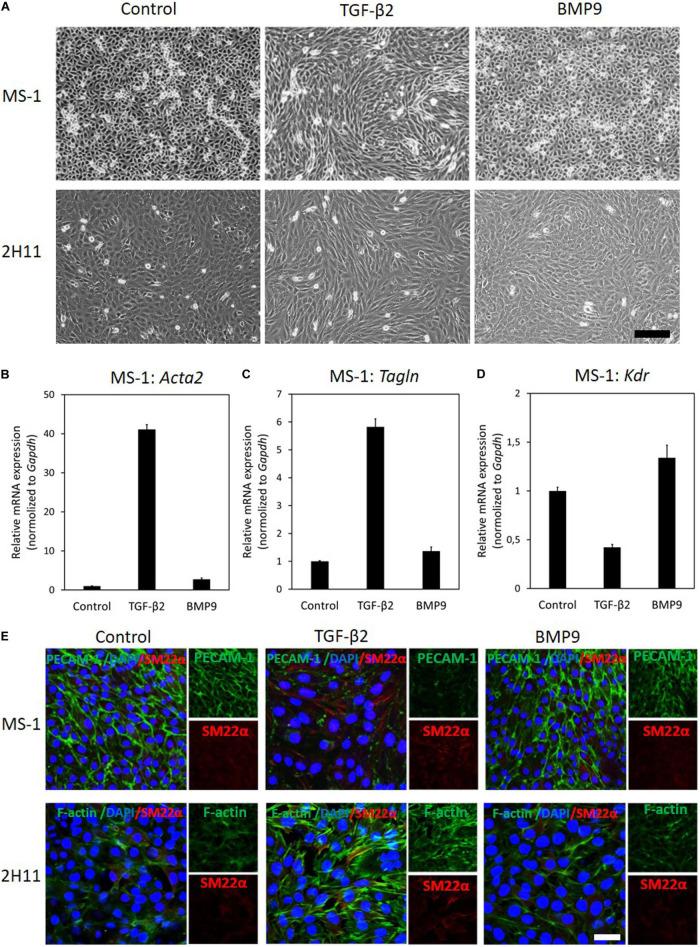 https://cdn.ncbi.nlm.nih.gov/pmc/blobs/00de/7907445/cc14fefd8278/fcell-09-616610-g001.jpg
