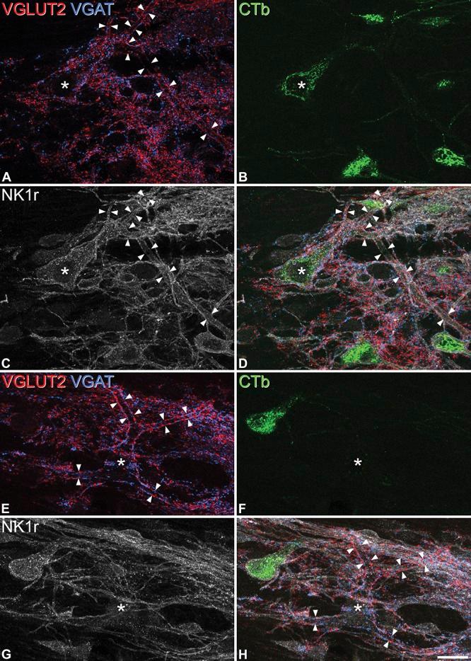https://cdn.ncbi.nlm.nih.gov/pmc/blobs/00e1/4770364/7e41d2a12bc6/jop-156-2061-g006.jpg