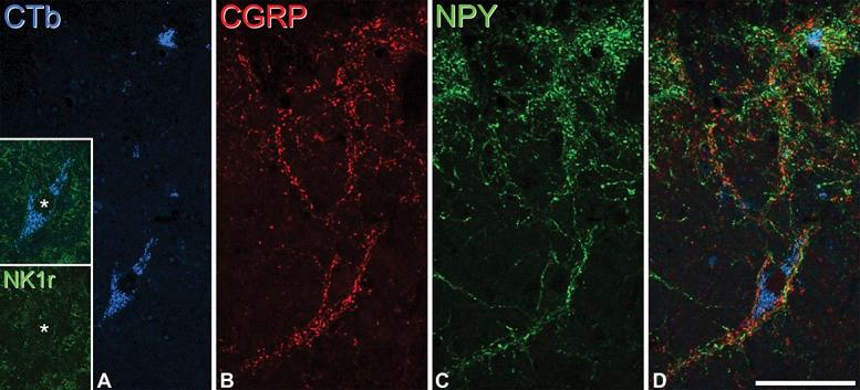 https://cdn.ncbi.nlm.nih.gov/pmc/blobs/00e1/4770364/c494ec6c1608/jop-156-2061-g008.jpg