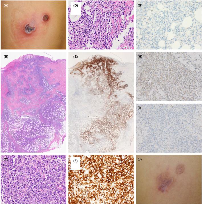 https://cdn.ncbi.nlm.nih.gov/pmc/blobs/00e8/7752389/17057aeafb2e/CCR3-8-2418-g002.jpg