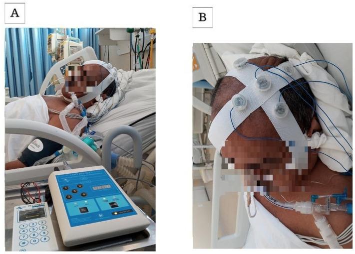 https://cdn.ncbi.nlm.nih.gov/pmc/blobs/00ec/9093082/4cbcfe36f571/gr1_lrg.jpg