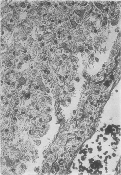 https://cdn.ncbi.nlm.nih.gov/pmc/blobs/00f3/480405/31dc43037f63/jclinpath00069-0026-b.jpg