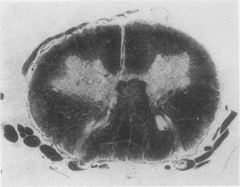 https://cdn.ncbi.nlm.nih.gov/pmc/blobs/00f3/480405/4c6497c06fa1/jclinpath00069-0028-d.jpg