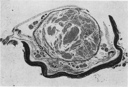 https://cdn.ncbi.nlm.nih.gov/pmc/blobs/00f3/480405/4e75516d18f7/jclinpath00069-0029-b.jpg