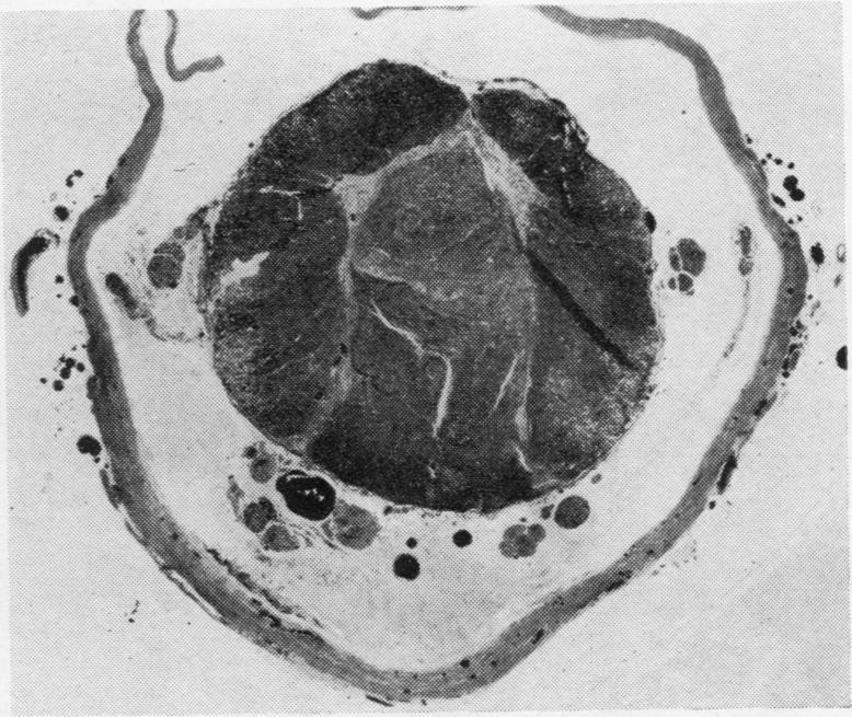 https://cdn.ncbi.nlm.nih.gov/pmc/blobs/00f3/480405/6244d41811a7/jclinpath00069-0029-a.jpg