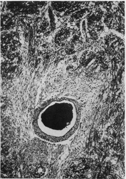 https://cdn.ncbi.nlm.nih.gov/pmc/blobs/00f3/480405/723c84dd9034/jclinpath00069-0027-a.jpg