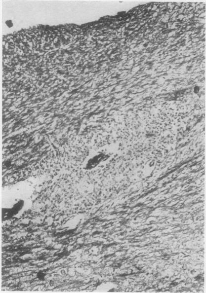 https://cdn.ncbi.nlm.nih.gov/pmc/blobs/00f3/480405/974a3c358321/jclinpath00069-0030-a.jpg