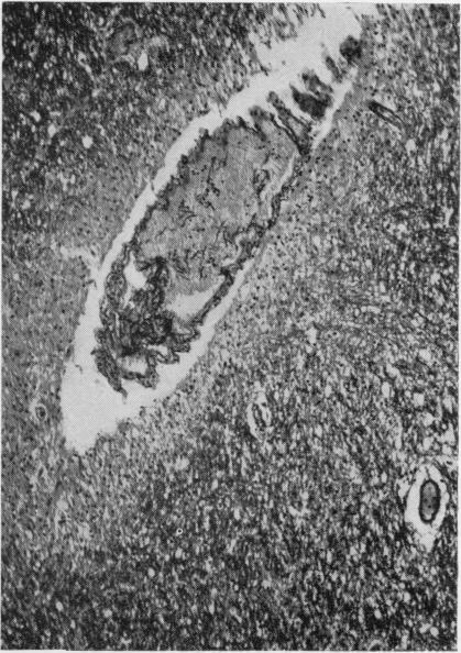 https://cdn.ncbi.nlm.nih.gov/pmc/blobs/00f3/480405/9b5c6b329ad4/jclinpath00069-0027-b.jpg