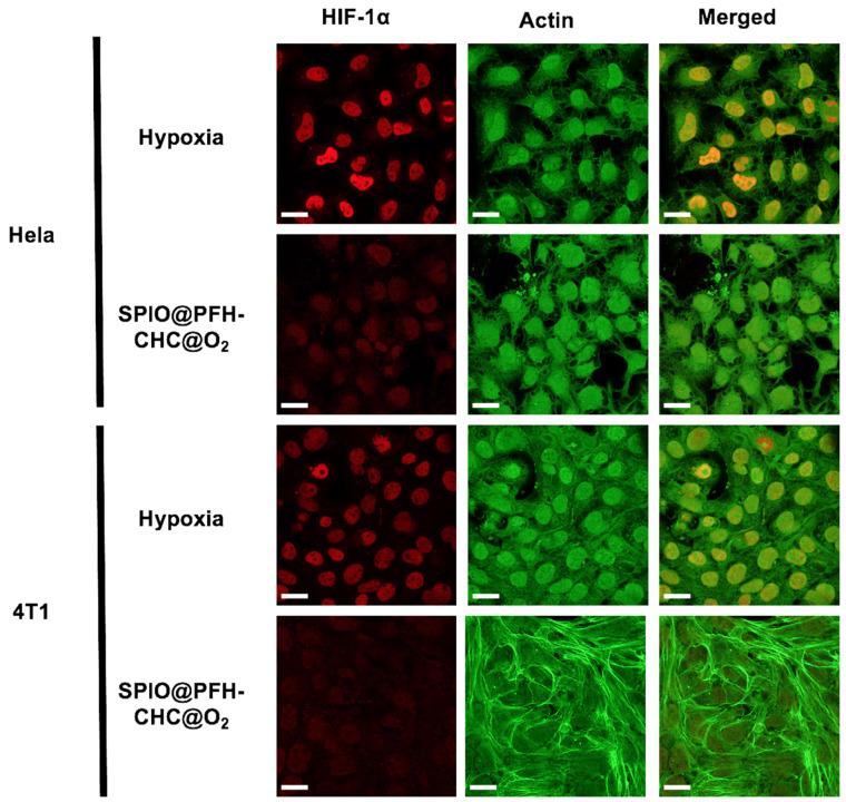 https://cdn.ncbi.nlm.nih.gov/pmc/blobs/00f4/11723374/698fdd5d4922/nanomaterials-15-00037-g003.jpg