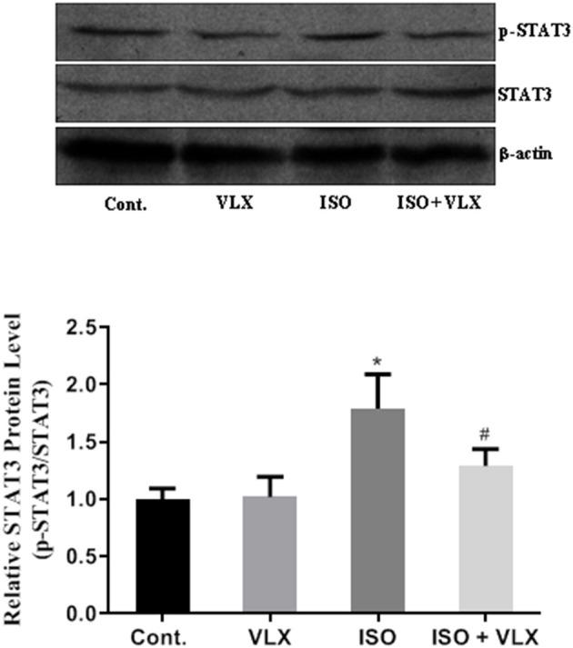 https://cdn.ncbi.nlm.nih.gov/pmc/blobs/00f8/7940694/310f8e392ad6/fneur-12-591223-g0004.jpg