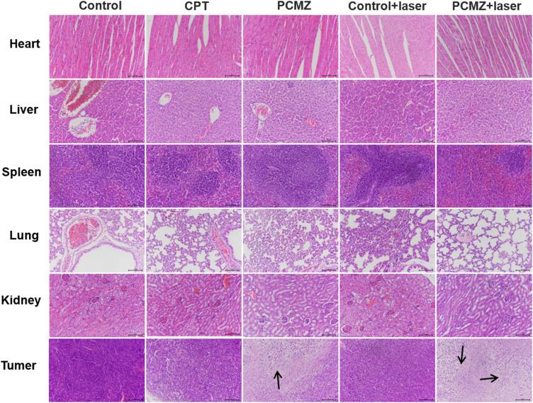 https://cdn.ncbi.nlm.nih.gov/pmc/blobs/0101/11344551/b6a4912a8ac1/IJN-19-8501-g0009.jpg