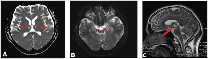 https://cdn.ncbi.nlm.nih.gov/pmc/blobs/0103/10025331/02f7d506cb44/fnins-17-1139537-g0002.jpg
