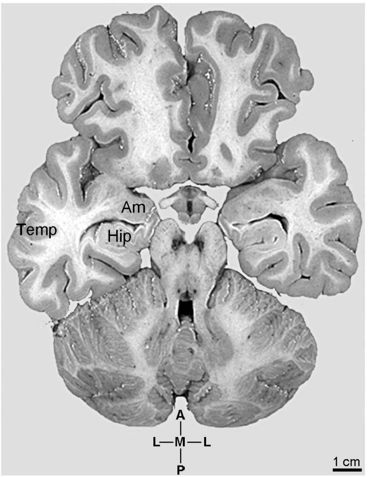 https://cdn.ncbi.nlm.nih.gov/pmc/blobs/0107/7991104/8a8f5cf092df/fnsyn-13-616607-g001.jpg