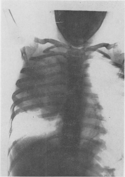 https://cdn.ncbi.nlm.nih.gov/pmc/blobs/0109/1613514/299158a5f85d/annsurg01304-0041-b.jpg