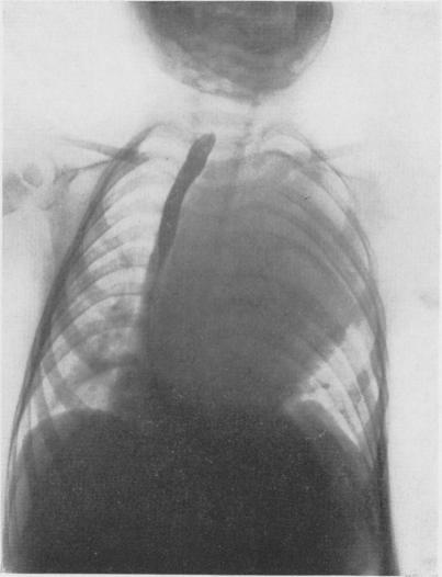 https://cdn.ncbi.nlm.nih.gov/pmc/blobs/0109/1613514/a23fa8e0a674/annsurg01304-0041-c.jpg