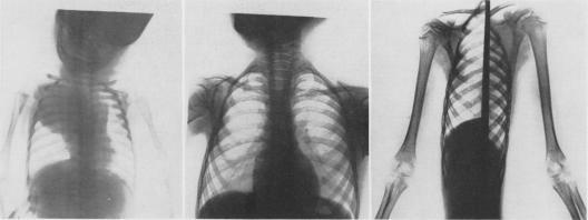 https://cdn.ncbi.nlm.nih.gov/pmc/blobs/0109/1613514/b3404d687958/annsurg01304-0042-b.jpg