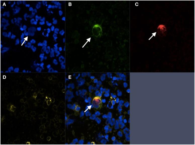 https://cdn.ncbi.nlm.nih.gov/pmc/blobs/0112/3468833/ac9c5dfb882f/fonc-02-00131-g0001.jpg