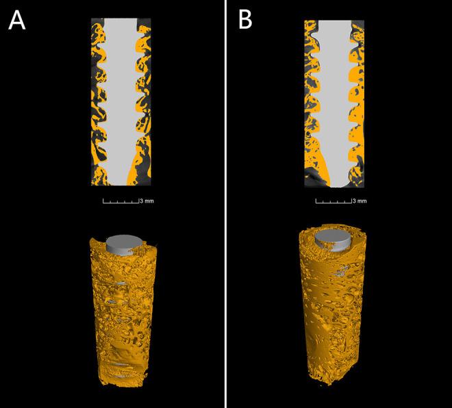 https://cdn.ncbi.nlm.nih.gov/pmc/blobs/0117/9972285/158bf88e49ac/10.1177_2192568221996692-fig3.jpg