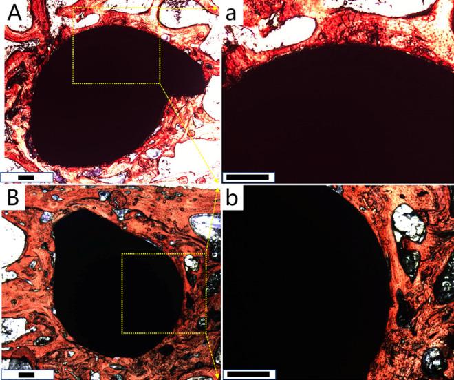 https://cdn.ncbi.nlm.nih.gov/pmc/blobs/0117/9972285/2e68acd16757/10.1177_2192568221996692-fig4.jpg