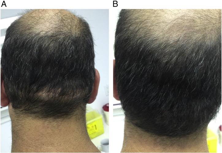 https://cdn.ncbi.nlm.nih.gov/pmc/blobs/0119/5419059/606b26c8b575/gr8.jpg