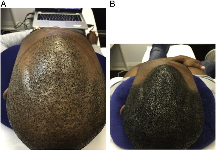 https://cdn.ncbi.nlm.nih.gov/pmc/blobs/0119/5419059/6afaefc8ed62/gr9.jpg