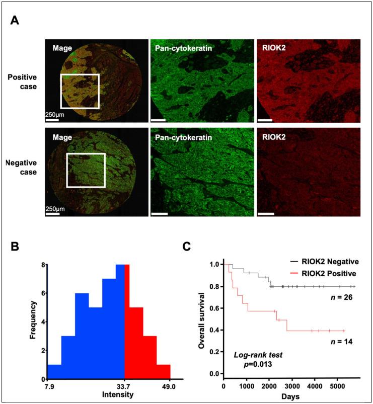 https://cdn.ncbi.nlm.nih.gov/pmc/blobs/011a/9857684/872c56bfa36e/curroncol-30-00031-g001.jpg
