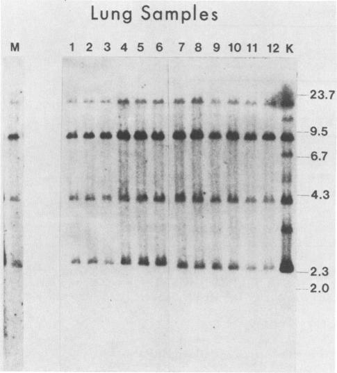 https://cdn.ncbi.nlm.nih.gov/pmc/blobs/0120/254481/658226e18ca6/jvirol00127-0016-a.jpg