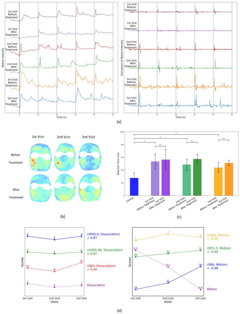 https://cdn.ncbi.nlm.nih.gov/pmc/blobs/0124/12249283/a2ea058f19d0/diagnostics-15-01574-g004.jpg